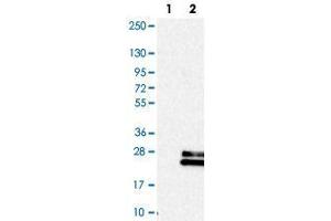 Western blot analysis of Lane 1: Negative control (vector only transfected HEK293T lysate), Lane 2: Over-expression Lysate (Co-expressed with a C-terminal myc-DDK tag (~3. (Relaxin 3 抗体)