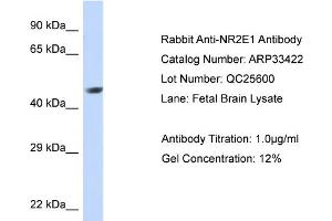 WB Suggested Anti-NR2E1 Antibody Titration:  0.