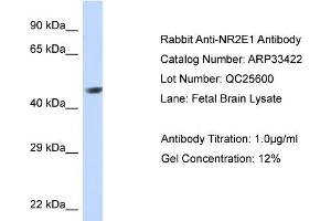 WB Suggested Anti-NR2E1 Antibody Titration:  0. (NR2E1 抗体  (Middle Region))