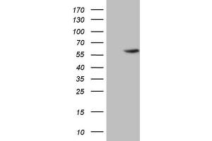 Western Blotting (WB) image for anti-4-Aminobutyrate Aminotransferase (ABAT) (AA 29-323) antibody (ABIN2715601) (ABAT 抗体  (AA 29-323))