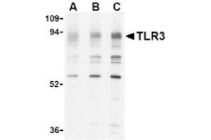 Image no. 1 for anti-Toll-Like Receptor 3 (TLR3) (N-Term) antibody (ABIN265140) (TLR3 抗体  (N-Term))