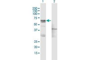Western Blot analysis of ASNS expression in transfected 293T cell line by ASNS MaxPab polyclonal antibody. (Asparagine Synthetase 抗体  (AA 1-561))