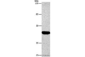 Western blot analysis of Hela cell, using CTGF Polyclonal Antibody at dilution of 1:850 (CTGF 抗体)
