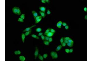 Immunofluorescence staining of PC-3 cells with ABIN7160740 at 1:133, counter-stained with DAPI. (NAA38 抗体  (AA 2-173))