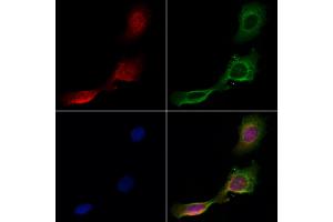 ABIN6261240 and ABIN6266855 staining Hela cells by IF/ICC. (DCP1A 抗体  (Internal Region))