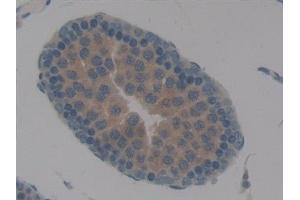 Detection of TBX21 in Rat Testis Tissue using Polyclonal Antibody to T-Box Protein 21 (TBX21) (T-Bet 抗体  (AA 241-493))