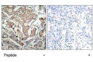 Image no. 1 for anti-BCL2-Associated Agonist of Cell Death (BAD) (Ser155) antibody (ABIN197212) (BAD 抗体  (Ser155))