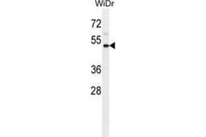Western blot analysis in WiDr cell line lysates (35ug/lane) using CD121b / IL1R2  Antibody . (IL1R2 抗体  (Middle Region))