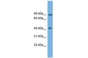 Image no. 1 for anti-Dual-Specificity tyrosine-(Y)-phosphorylation Regulated Kinase 1A (DYRK1A) (AA 107-156) antibody (ABIN6743391)