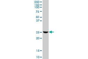 Western Blotting (WB) image for anti-Glutathione S-Transferase omega 1 (GSTO1) (AA 1-241) antibody (ABIN522902)