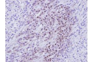 IHC-P Image Immunohistochemical analysis of paraffin-embedded SAS Xenograft , using RBMY1A1, antibody at 1:100 dilution. (RBMY1A1 抗体)