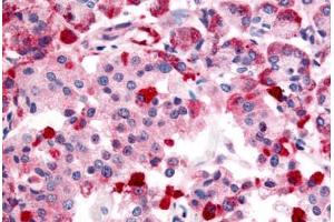 Immunohistochemistry (IHC) image for anti-Transient Receptor Potential Cation Channel, Subfamily M, Member 4 (TRPM4) (Internal Region) antibody (ABIN1049433)