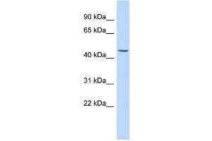 WB Suggested Anti-KRT24 Antibody Titration: 0. (Keratin 24 抗体  (Middle Region))