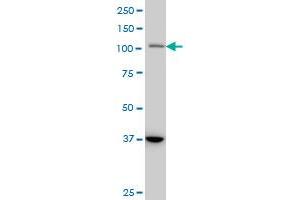 STAT2 monoclonal antibody (M01), clone 5G7 Western Blot analysis of STAT2 expression in A-431 . (STAT2 抗体  (AA 742-851))
