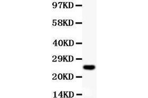 Western Blotting (WB) image for anti-Cyclin D3 (CCND3) (AA 136-292) antibody (ABIN3043485)