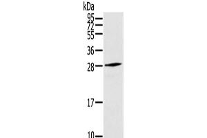 Western Blot analysis of Human fetal muscle tissue using THYN1 Polyclonal Antibody at dilution of 1/800
