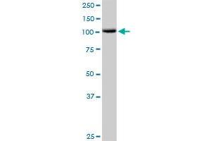 CDH1 MaxPab rabbit polyclonal antibody. (E-cadherin 抗体  (AA 1-882))