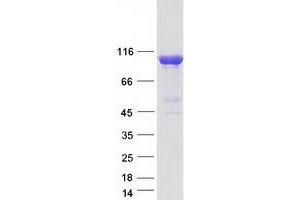 Validation with Western Blot