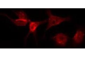 ABIN6275972 staining Hela by IF/ICC. (Angiotensin II Type-1 Receptor 抗体  (N-Term))
