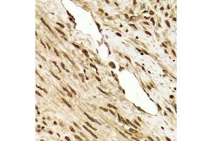 Immunohistochemistry of paraffin-embedded human leiomyoma of uterus using ANP32A Antibody. (PHAP1 抗体  (AA 1-170))