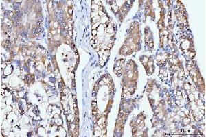 IHC analysis of DHODH using anti-DHODH antibody (ABIN7603139). (DHODH 抗体  (N-Term))