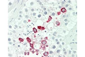 Formalin-fixed and paraffin-embedded H. (IFNA4 抗体  (C-Term))