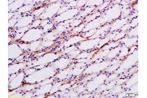 Formalin-fixed and paraffin embedded rat kidney tissue labeled with Anti-ENaCg/γENaC Polyclonal Antibody, Unconjugated at 1:200 followed by conjugation to the secondary antibody and DAB staining (SCNN1G 抗体  (AA 188-290))