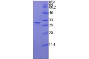 SDS-PAGE analysis of Human Fucosyltransferase 4 Protein. (CD15 蛋白)