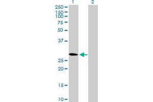 Western Blot analysis of CMTM2 expression in transfected 293T cell line by CMTM2 MaxPab polyclonal antibody. (CMTM2 抗体  (AA 1-248))