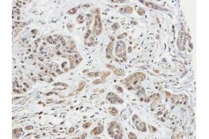 IHC-P Image Immunohistochemical analysis of paraffin-embedded A549 xenograft, using ARPC1A, antibody at 1:100 dilution.