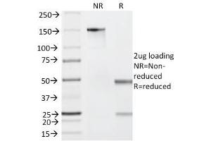 SDS-PAGE Analysis Purified Granzyme B Mouse Monoclonal Antibody (GZMB/2403). (GZMB 抗体  (AA 73-187))