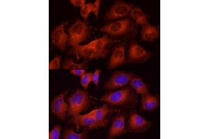 Immunofluorescence (IF) image for anti-Cortactin (CTTN) (AA 214-513) antibody (ABIN6139243)