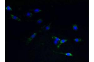 Immunofluorescent analysis of NIH/3T3 cells using ABIN7170878 at dilution of 1:100 and Alexa Fluor 488-congugated AffiniPure Goat Anti-Rabbit IgG(H+L) (TACR1 抗体  (AA 1-29))