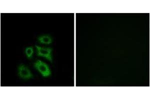 Immunofluorescence analysis of A549 cells, using CLIP3 Antibody. (CLIP3 抗体  (AA 361-410))