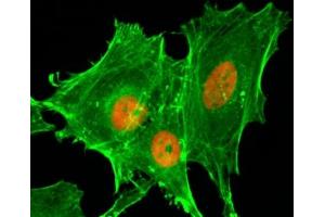 ICC/IF staining of HeLa cells treated with sodium butyrate using recombinant H4K20ac antibody (red).