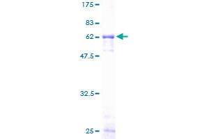 Image no. 1 for Interleukin 2 Receptor, gamma (IL2RG) (AA 1-369) protein (GST tag) (ABIN1307808) (IL2RG Protein (AA 1-369) (GST tag))