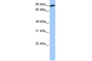 WB Suggested Anti-WDFY3 Antibody Titration:  0. (WDFY3 抗体  (C-Term))