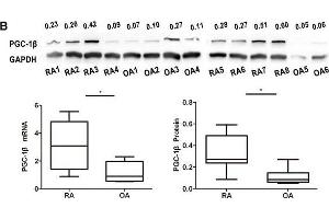 Expression of peroxisome proliferator-activated receptor-gamma coactivator-1 β (PGC-1β) is over-expressed in rheumatoid arthritis (RA)-fibrolast-like synoviocytes (FLS). (PPARGC1B 抗体  (AA 901-1023))