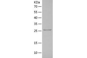 Western Blotting (WB) image for Kallikrein 2 (KLK2) (AA 25-261) protein (His tag) (ABIN7123661)