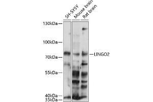 Western blot analysis of extracts of various cell lines, using LINGO2 antibody (ABIN7268216) at 1:1000 dilution. (LINGO2 抗体  (AA 370-540))