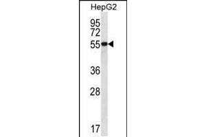 Western blot analysis in HepG2 cell line lysates (35ug/lane). (UGDH 抗体  (C-Term))