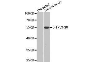 Western Blotting (WB) image for anti-Tumor Protein P53 (TP53) (pSer6) antibody (ABIN1870678) (p53 抗体  (pSer6))