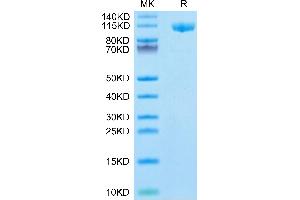 CD22 Molecule (CD22) (AA 22-702) protein (His tag)