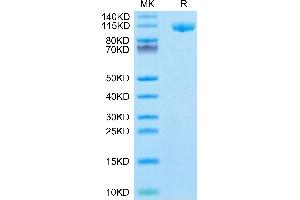 Mouse Siglec-2/CD22 on Tris-Bis PAGE under reduced condition. (CD22 Protein (AA 22-702) (His tag))