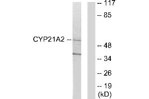 Western blot analysis of extracts from 293 cells, using Cytochrome P450 21A2 antibody. (CYP21A2 抗体)