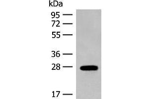 Western blot analysis of Mouse eye tissue lysate using GUCA1B Polyclonal Antibody at dilution of 1:500 (GUCA1B 抗体)