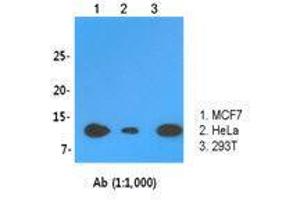 The cell lysates (30 ug) were resolved by SDS-PAGE, transferred to PVDF membrane and probed with LSm2 antibody (1:1,000). (LSM2 抗体  (AA 1-95))