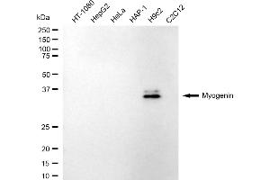 Western blotting analysis using myogenin antibody (ABIN7799518).