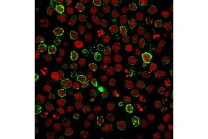 Immunofluorescence staining of Ramos cells using CD10 Mouse Monoclonal Antibody (FR4D11) followed by goat anti-Mouse IgG conjugated to CF488 (green).