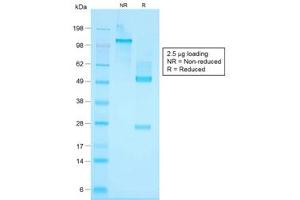 SDS-PAGE analysis of purified, BSA-free recombinant Basic Cytokeratin antibody (clone KRTH/1576R) as confirmation of integrity and purity. (Recombinant Keratin Basic 抗体)